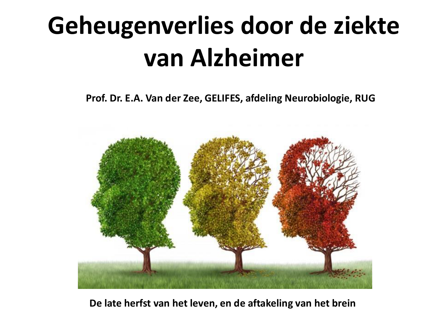 De Ziekte Van Alzheimer Neerlandes Para Todos